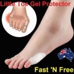 Person with silicone bunion protector Australia White color, front view, showing gel guard.
