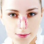 Person with nose shaping clip Australia Clear color, front view, showing silicone pads.