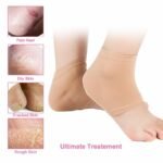 Person with gel heel socks Australia Skin color, front view, showing open toe design.