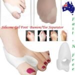 Person with silicone bunion protector Australia White color, front view, showing gel design.